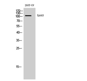 Western blot - EphA3 Polyclonal Antibody from Signalway Antibody (40887) - Antibodies.com