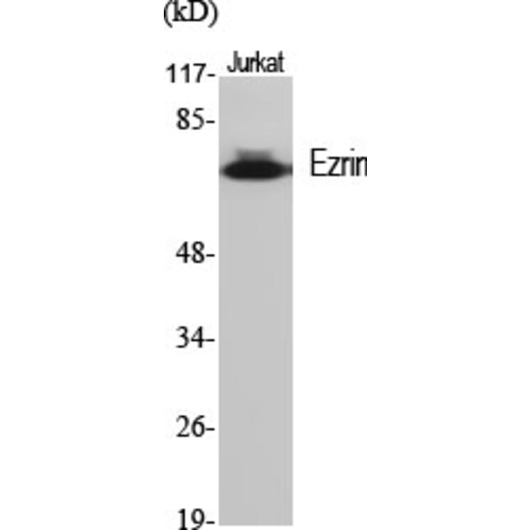 Western blot - Ezrin Polyclonal Antibody from Signalway Antibody (40910) - Antibodies.com