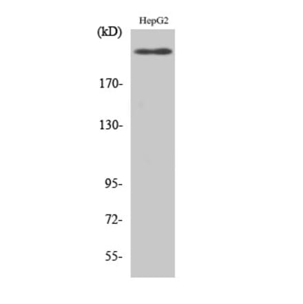 Western blot - Flk-1 Polyclonal Antibody from Signalway Antibody (40930) - Antibodies.com