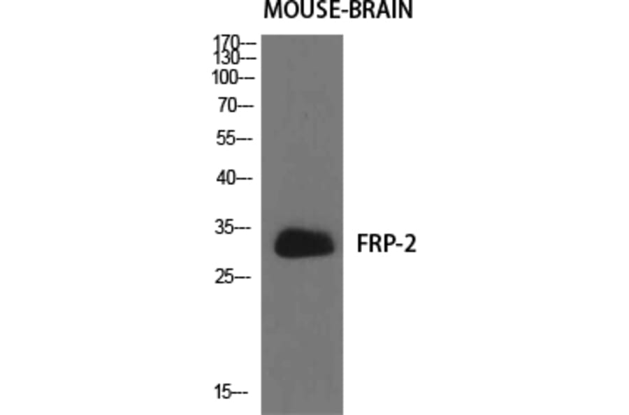 Western blot - FRP-2 Polyclonal Antibody from Signalway Antibody (40940) - Antibodies.com