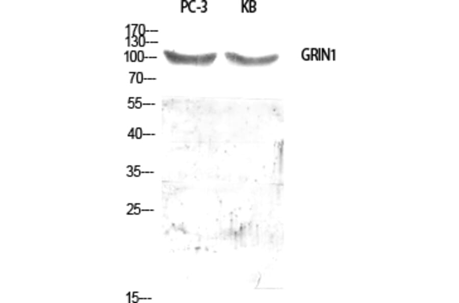 Western blot - GRIN1 Polyclonal Antibody from Signalway Antibody (40986) - Antibodies.com