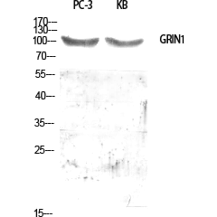 Western blot - GRIN1 Polyclonal Antibody from Signalway Antibody (40986) - Antibodies.com