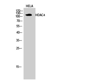 Western blot - HDAC4 Polyclonal Antibody from Signalway Antibody (40997) - Antibodies.com