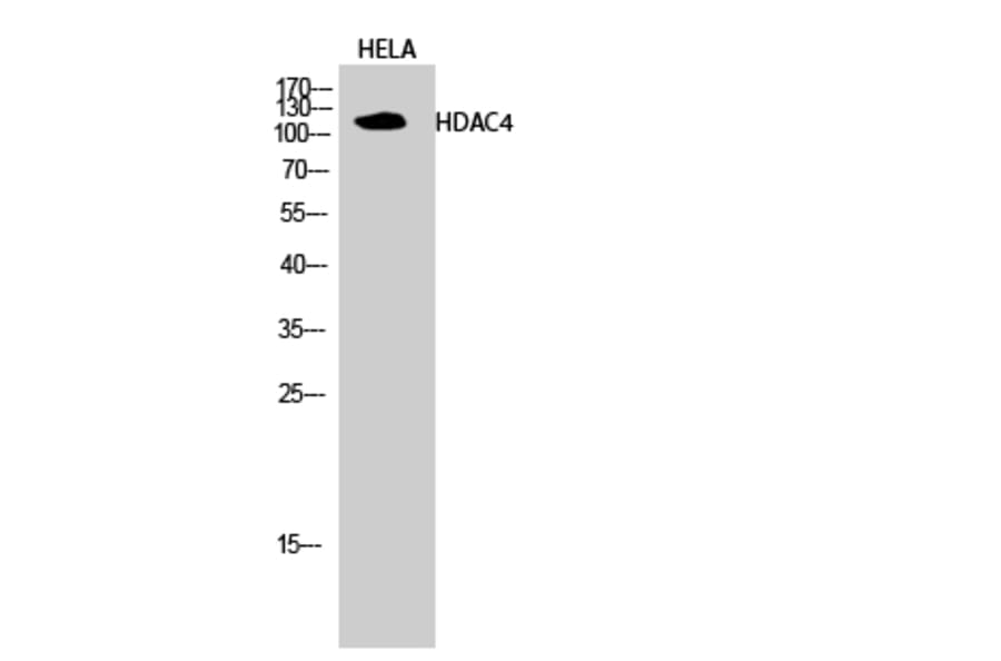 Western blot - HDAC4 Polyclonal Antibody from Signalway Antibody (40997) - Antibodies.com