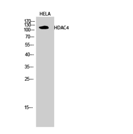 Western blot - HDAC4 Polyclonal Antibody from Signalway Antibody (40997) - Antibodies.com