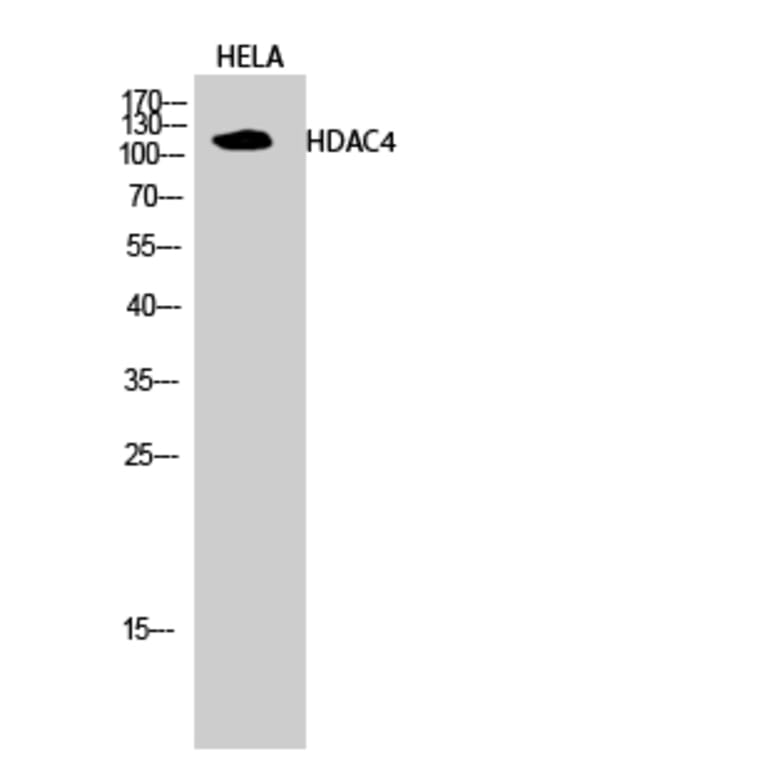 Western blot - HDAC4 Polyclonal Antibody from Signalway Antibody (40997) - Antibodies.com