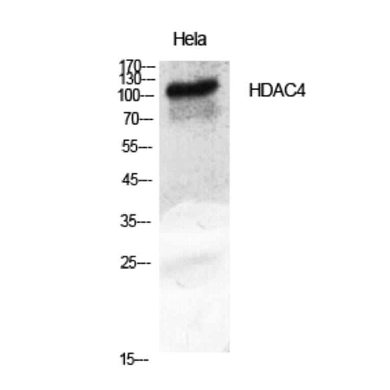 Western blot - HDAC4 Polyclonal Antibody from Signalway Antibody (40997) - Antibodies.com