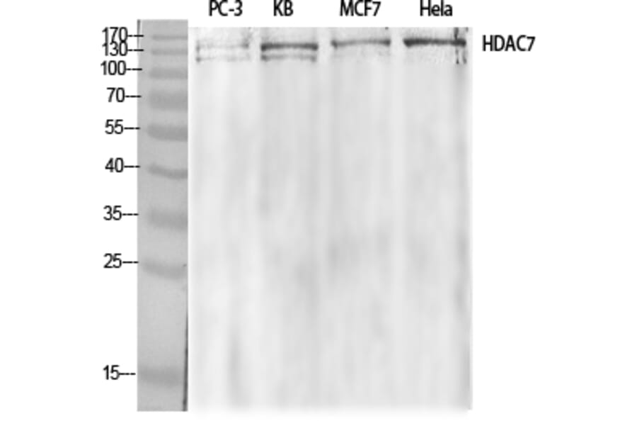 Western blot - HDAC7 Polyclonal Antibody from Signalway Antibody (41000) - Antibodies.com
