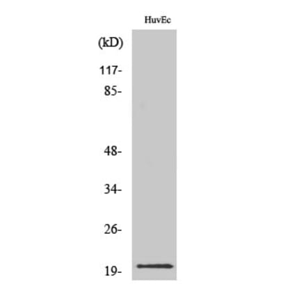 Western blot - IL-21 Polyclonal Antibody from Signalway Antibody (41060) - Antibodies.com