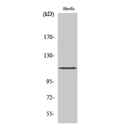 Western blot - KCNH1 Polyclonal Antibody from Signalway Antibody (41089) - Antibodies.com