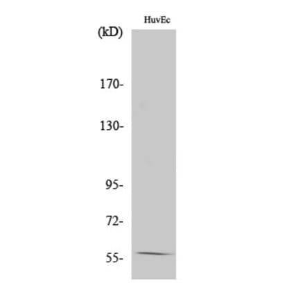 Western blot - KV1.1 Polyclonal Antibody from Signalway Antibody (41096) - Antibodies.com