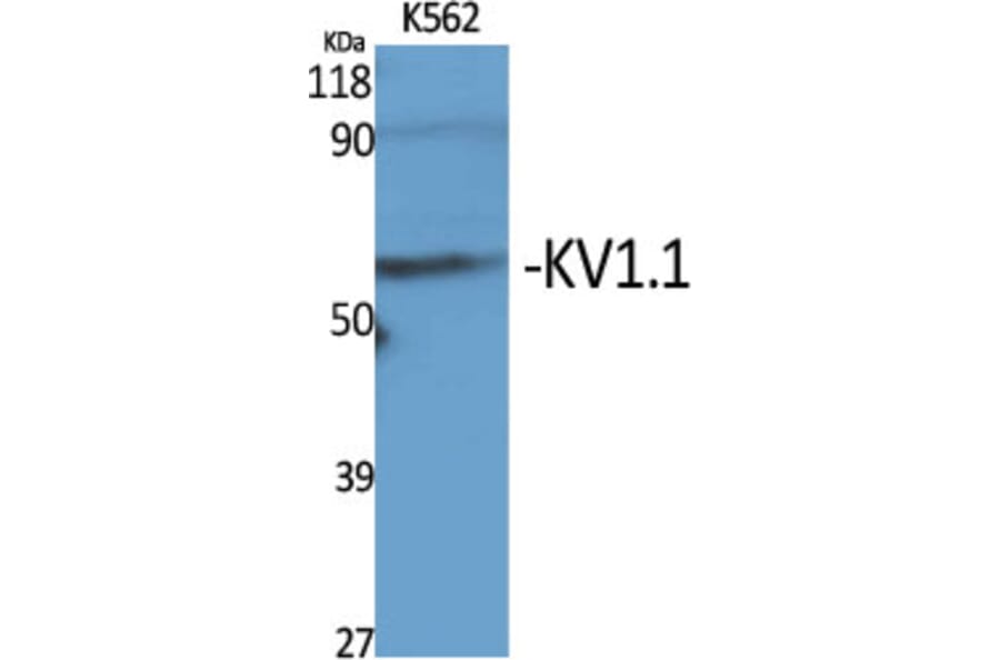 Western blot - KV1.1 Polyclonal Antibody from Signalway Antibody (41096) - Antibodies.com