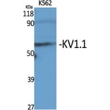 Western blot - KV1.1 Polyclonal Antibody from Signalway Antibody (41096) - Antibodies.com