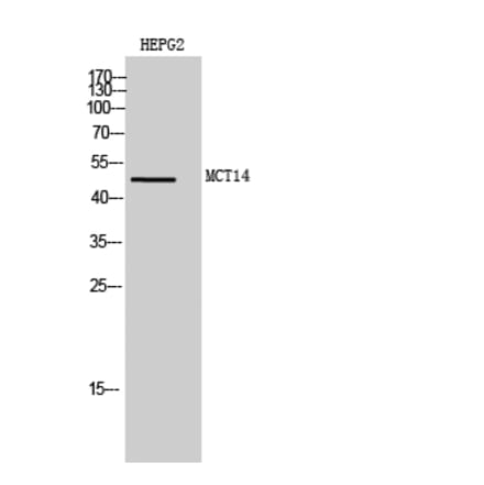 Western blot - MCT14 Polyclonal Antibody from Signalway Antibody (41125) - Antibodies.com