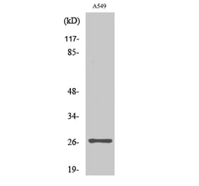 Western blot - NET-5 Polyclonal Antibody from Signalway Antibody (41214) - Antibodies.com