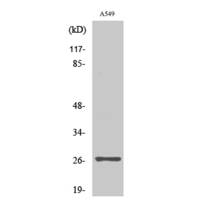 Western blot - NET-5 Polyclonal Antibody from Signalway Antibody (41214) - Antibodies.com