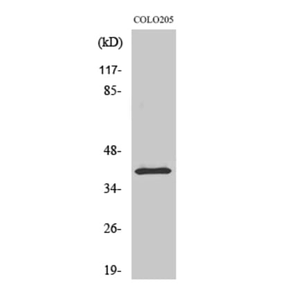 Western blot - p53R2 Polyclonal Antibody from Signalway Antibody (41314) - Antibodies.com