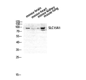 Western blot - PEPT1 Polyclonal Antibody from Signalway Antibody (41331) - Antibodies.com