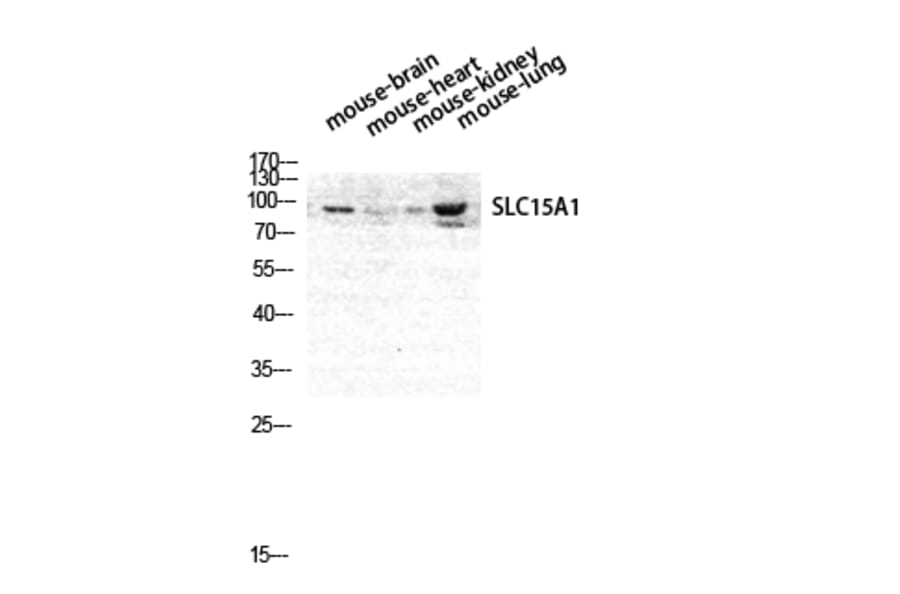Western blot - PEPT1 Polyclonal Antibody from Signalway Antibody (41331) - Antibodies.com