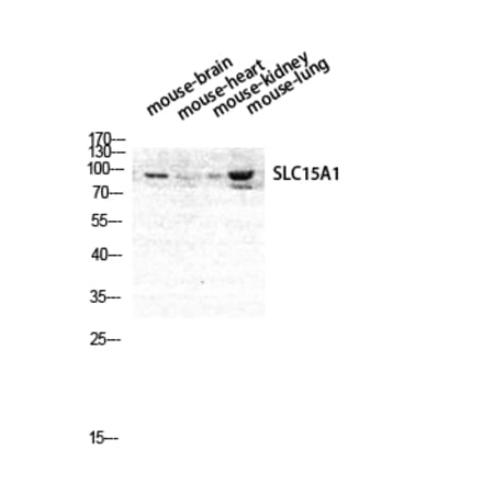 Western blot - PEPT1 Polyclonal Antibody from Signalway Antibody (41331) - Antibodies.com