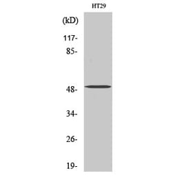 Western blot - SMYD2 Polyclonal Antibody from Signalway Antibody (41448) - Antibodies.com