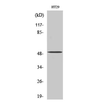 Western blot - SMYD2 Polyclonal Antibody from Signalway Antibody (41448) - Antibodies.com