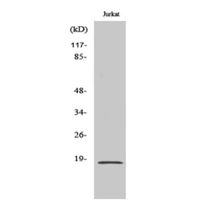 Western blot - SOD-1 Polyclonal Antibody from Signalway Antibody (41452) - Antibodies.com