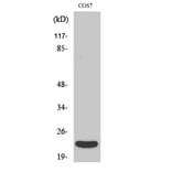 Western blot - TNF-β Polyclonal Antibody from Signalway Antibody (41505) - Antibodies.com
