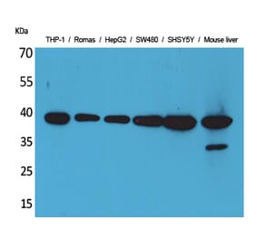 Western blot - IL-10 Polyclonal Antibody from Signalway Antibody (41553) - Antibodies.com