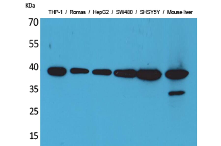 Western blot - IL-10 Polyclonal Antibody from Signalway Antibody (41553) - Antibodies.com