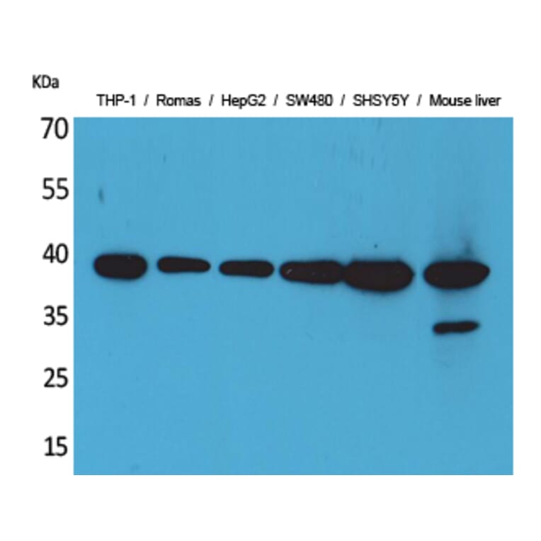 Western blot - IL-10 Polyclonal Antibody from Signalway Antibody (41553) - Antibodies.com