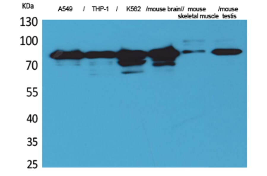 Western blot - PKC γ Polyclonal Antibody from Signalway Antibody (41563) - Antibodies.com