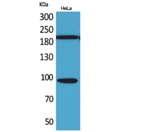Western blot - Trk C Polyclonal Antibody from Signalway Antibody (41576) - Antibodies.com