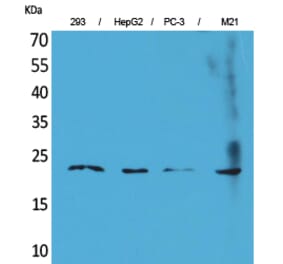 Western blot - FGF-6 Polyclonal Antibody from Signalway Antibody (41580) - Antibodies.com