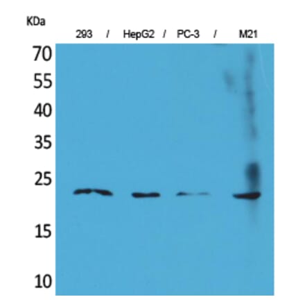 Western blot - FGF-6 Polyclonal Antibody from Signalway Antibody (41580) - Antibodies.com