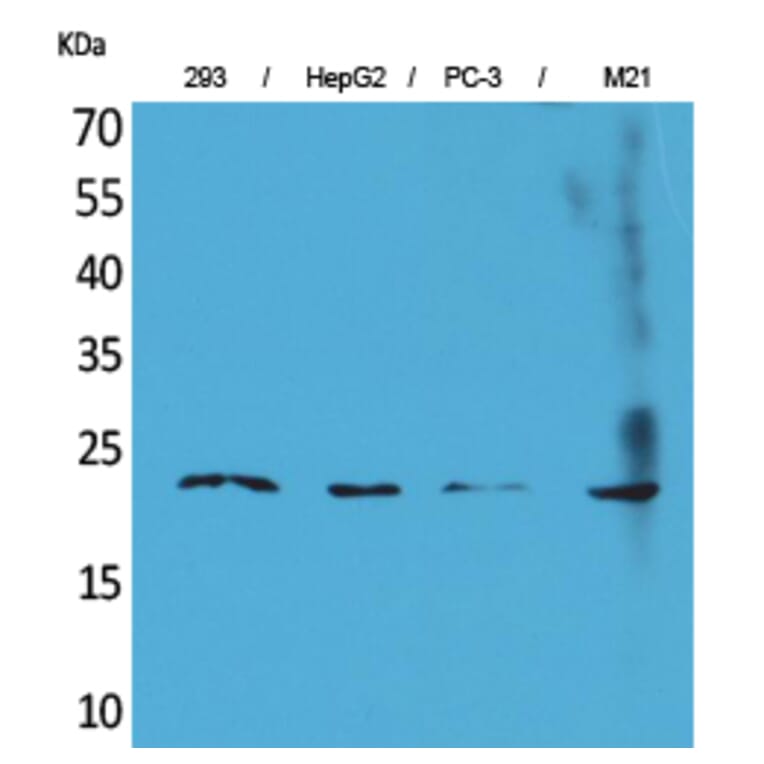 Western blot - FGF-6 Polyclonal Antibody from Signalway Antibody (41580) - Antibodies.com