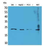 Western blot - FGF-6 Polyclonal Antibody from Signalway Antibody (41580) - Antibodies.com
