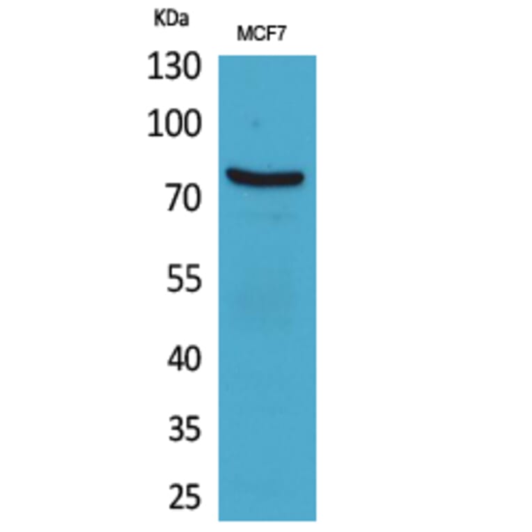 Western blot - CD66e Polyclonal Antibody from Signalway Antibody (41581) - Antibodies.com