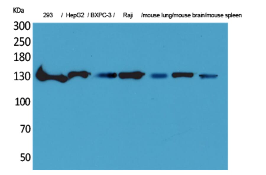 Western blot - IL-16 Polyclonal Antibody from Signalway Antibody (41584) - Antibodies.com