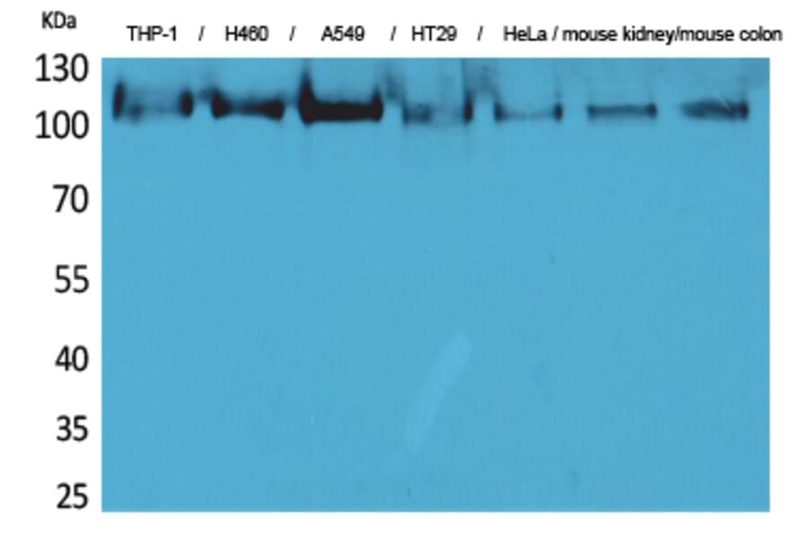 Western blot - cPLA2 Polyclonal Antibody from Signalway Antibody (41585) - Antibodies.com