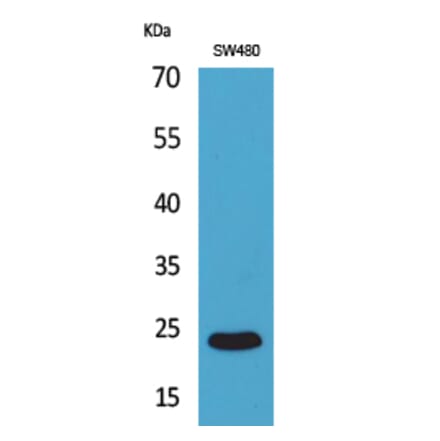 Western blot - FGF-9 Polyclonal Antibody from Signalway Antibody (41588) - Antibodies.com