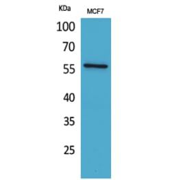 Western blot - ALK-1 Polyclonal Antibody from Signalway Antibody (41591) - Antibodies.com