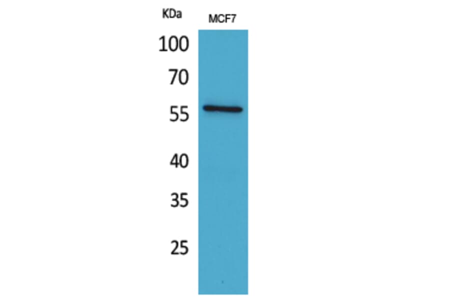 Western blot - ALK-1 Polyclonal Antibody from Signalway Antibody (41591) - Antibodies.com