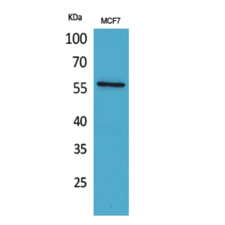 Western blot - ALK-1 Polyclonal Antibody from Signalway Antibody (41591) - Antibodies.com
