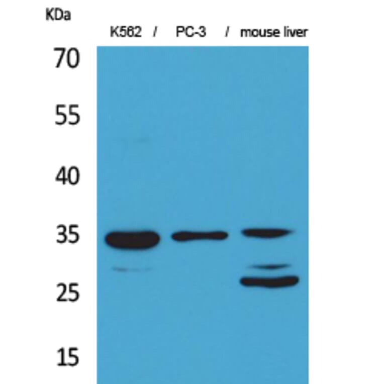 Western blot - Cdc34 Polyclonal Antibody from Signalway Antibody (41598) - Antibodies.com