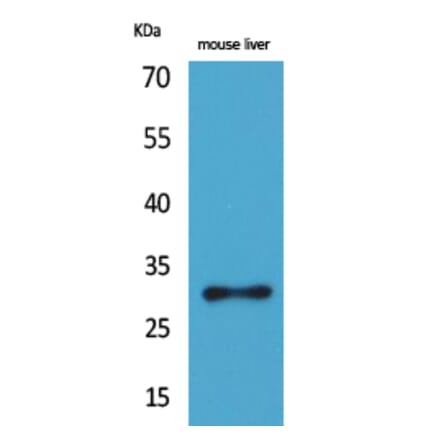 Western blot - FGF-5 Polyclonal Antibody from Signalway Antibody (41599) - Antibodies.com