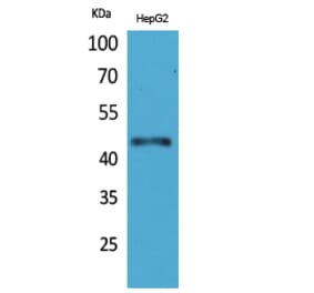 Western blot - HoxD3 Polyclonal Antibody from Signalway Antibody (41604) - Antibodies.com
