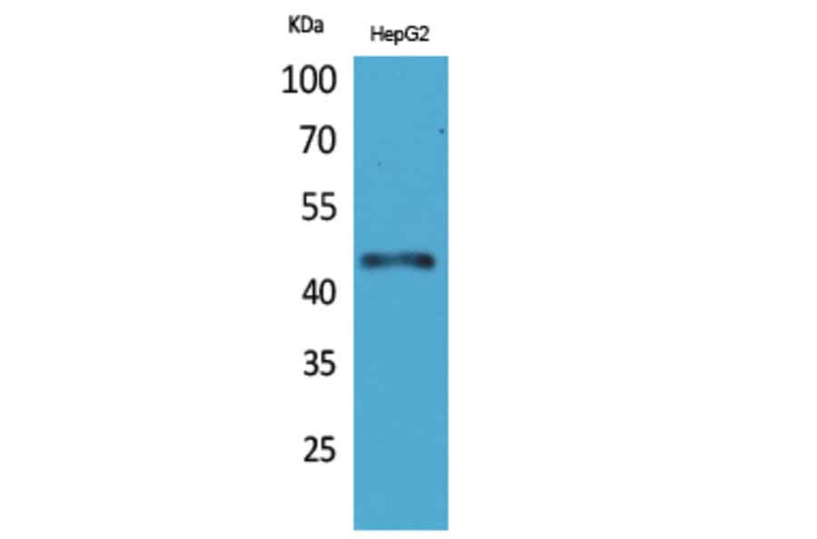 Western blot - HoxD3 Polyclonal Antibody from Signalway Antibody (41604) - Antibodies.com