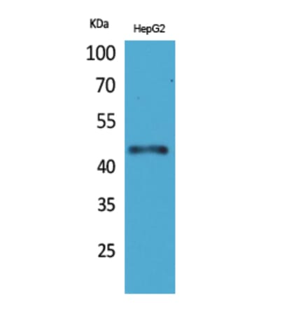 Western blot - HoxD3 Polyclonal Antibody from Signalway Antibody (41604) - Antibodies.com