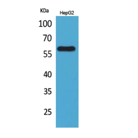 Western blot - ASIC3 Polyclonal Antibody from Signalway Antibody (41609) - Antibodies.com